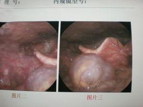 吃小瓜舌根发麻,揭秘小瓜为何引发舌根麻麻之感